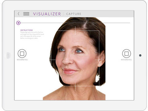 Allergan iVisualizer