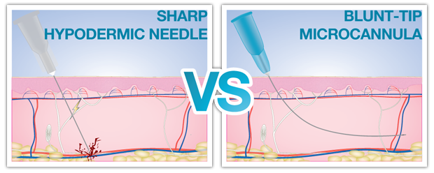 Needle vs. Cannula