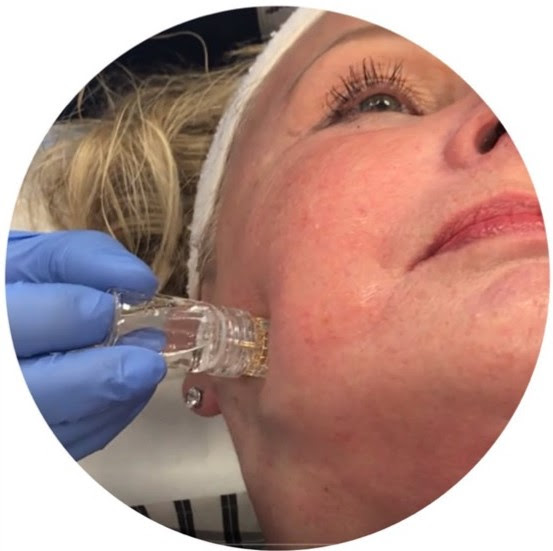 YPS Gold Filltox Facial
