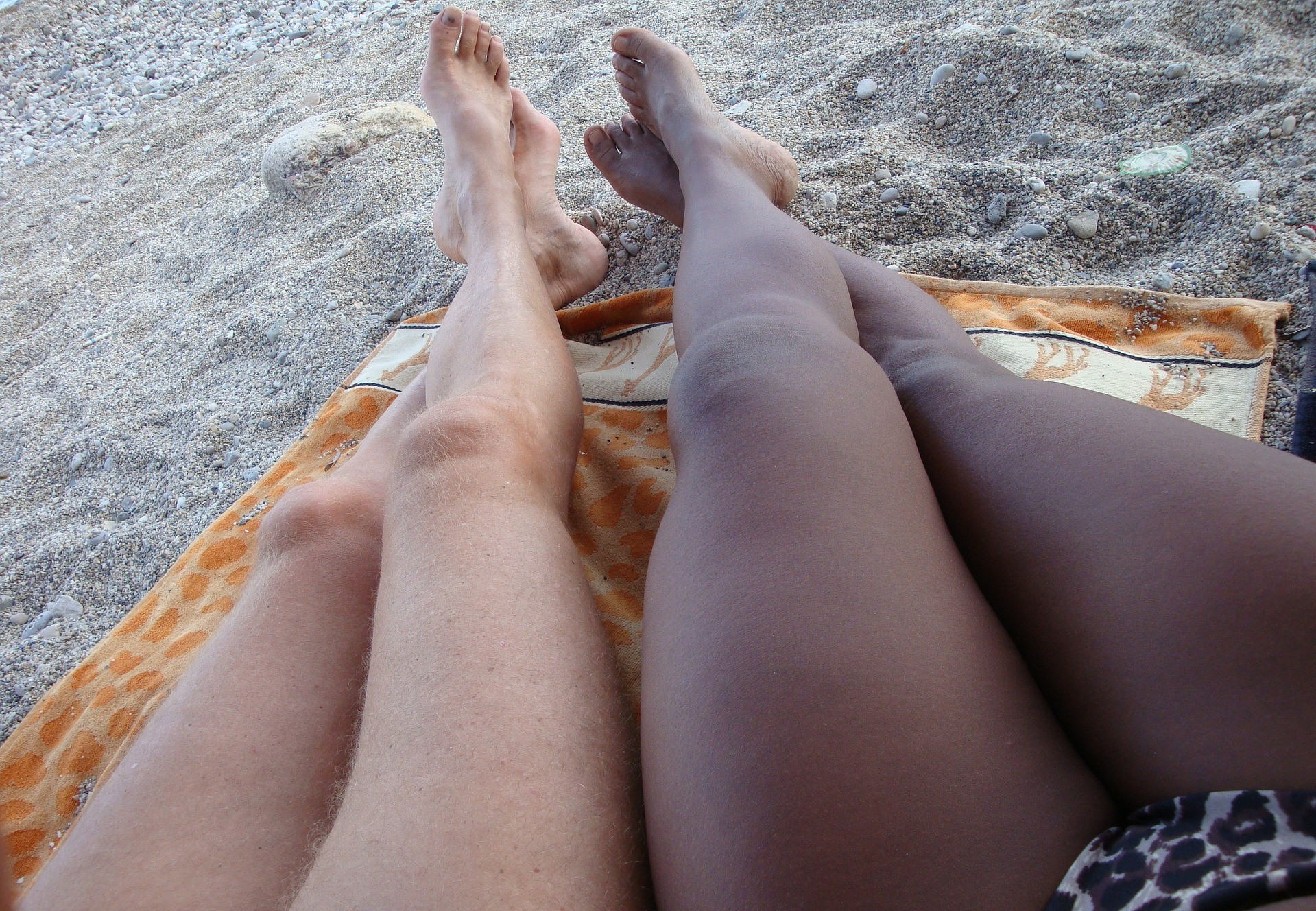 Legs Cellulite